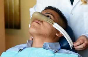 Nitrous Oxide Root Canal