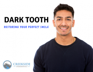 Dark Tooth Restoring Your Perfect Smile