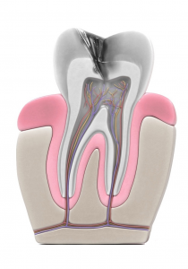 Infected Tooth Signs That You Need a Root Canal