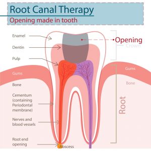 Nerves Affecting the Tooth